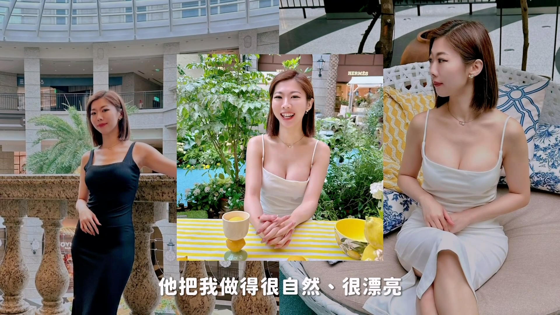 非常謝謝黃醫師，他把我做得很自然、很漂亮。其實我很多朋友看到，也都一直稱讚說真的很自然