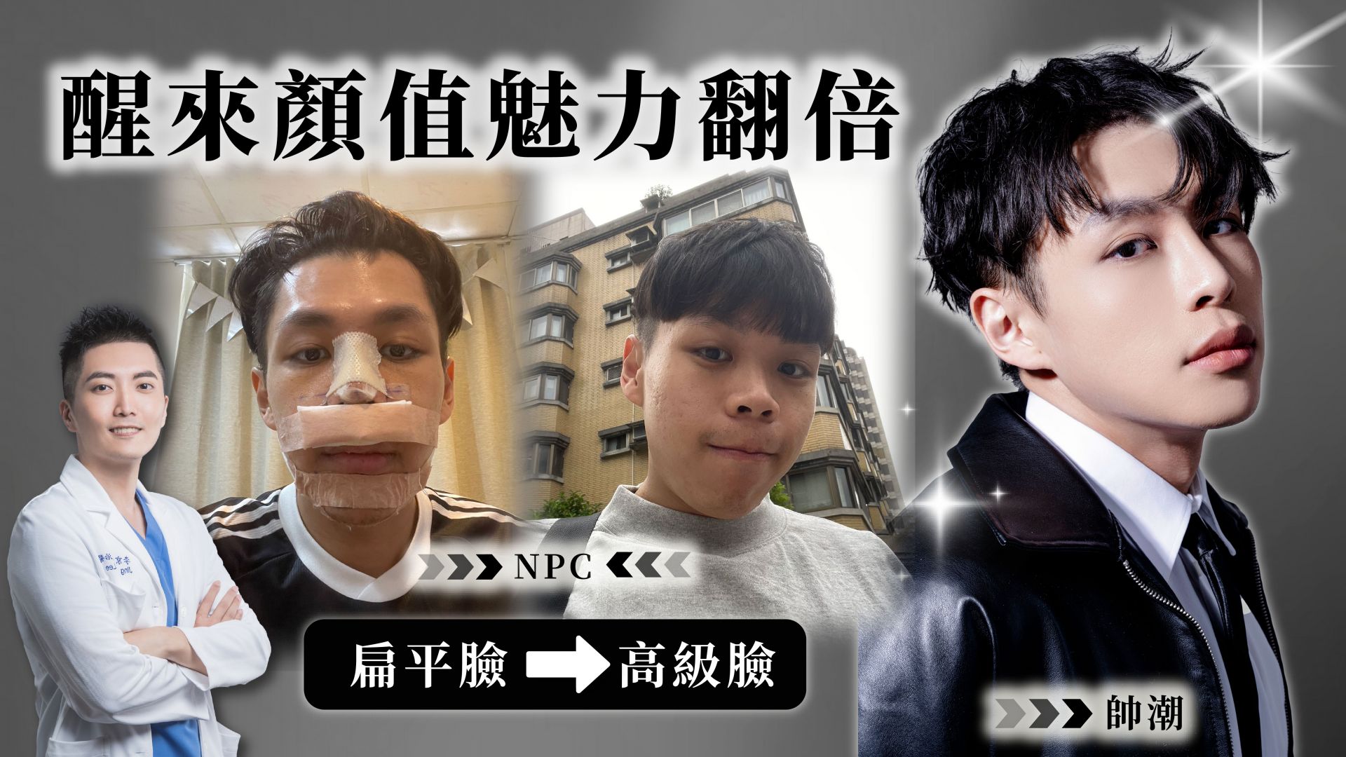 嘴凸不一定要縮唇!Edward結構式隆鼻+下巴截骨5個月見證