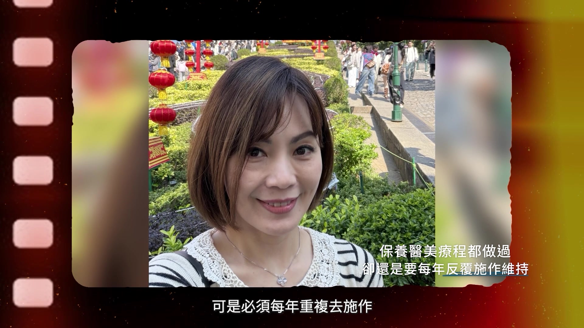 認真擦保養、電音波埋線每年重複施作，感覺效果有限，不夠極致