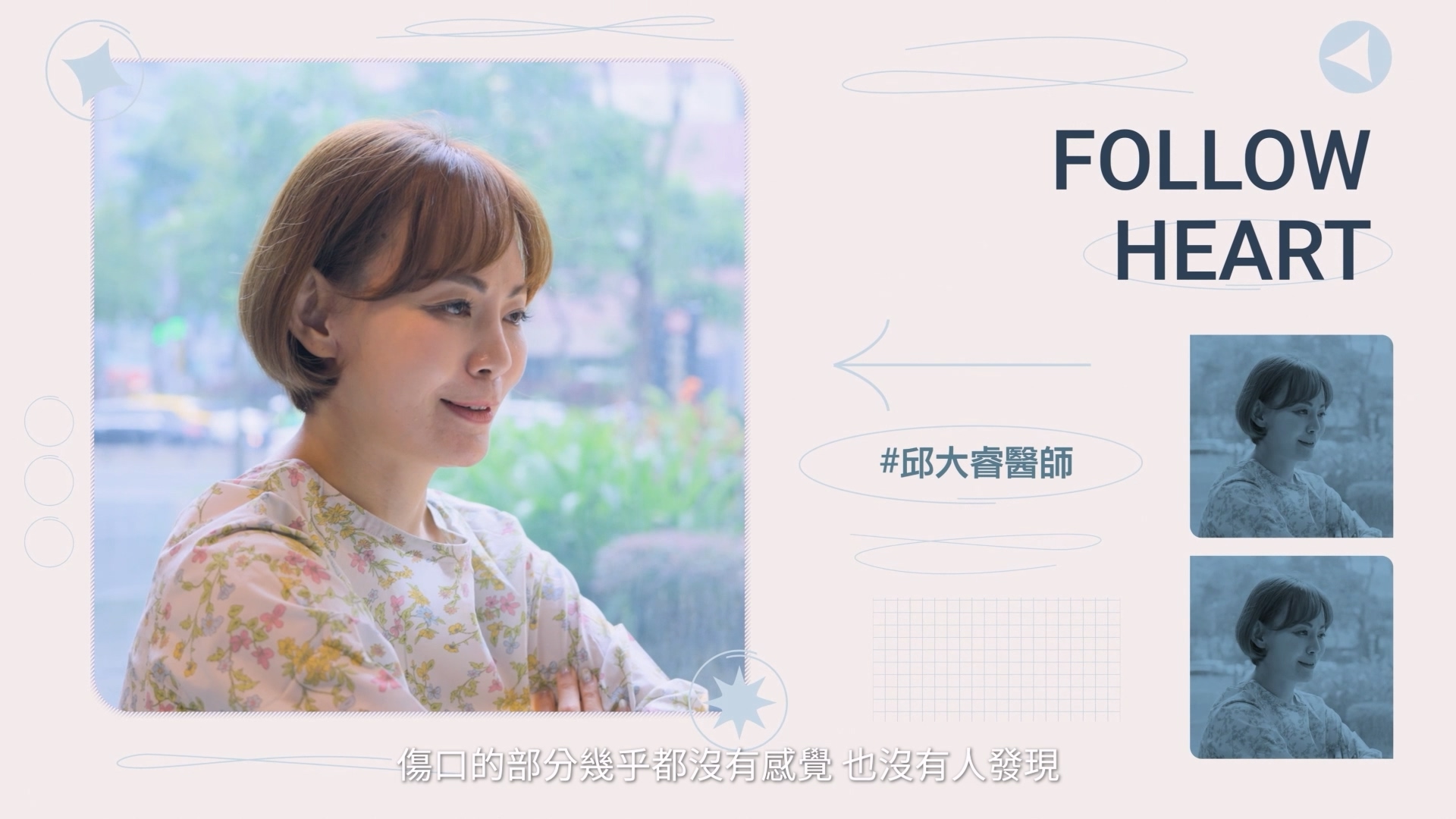 邱醫師的手術非常精湛，傷口不太需要照顧，沒什麼感覺，也沒有人發現