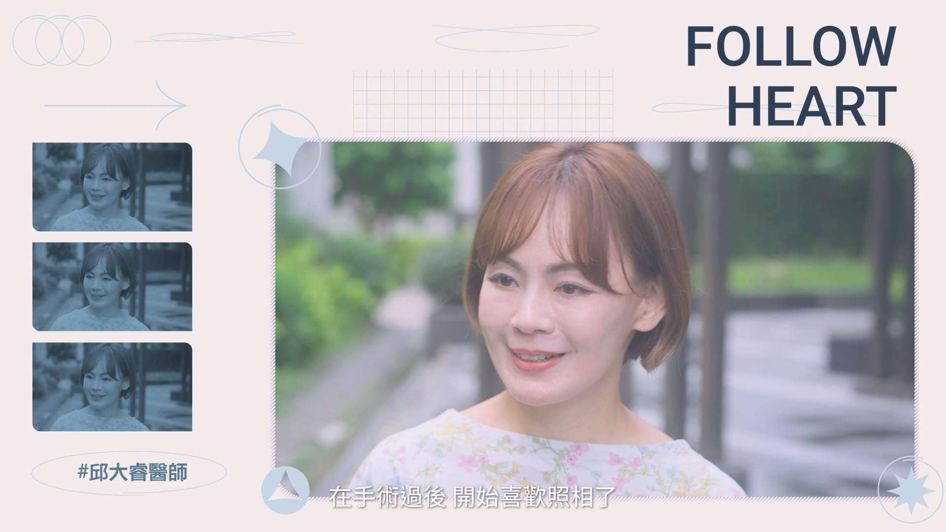拉皮手術後，開始喜歡照相，覺得整個人比較有精神、比較漂亮、比較年輕，同時又很自然