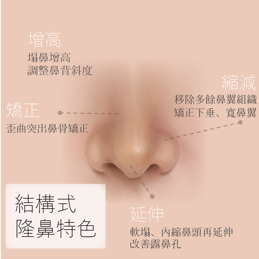 什麼是結構式隆鼻？一次看懂！各種隆鼻手術方式
