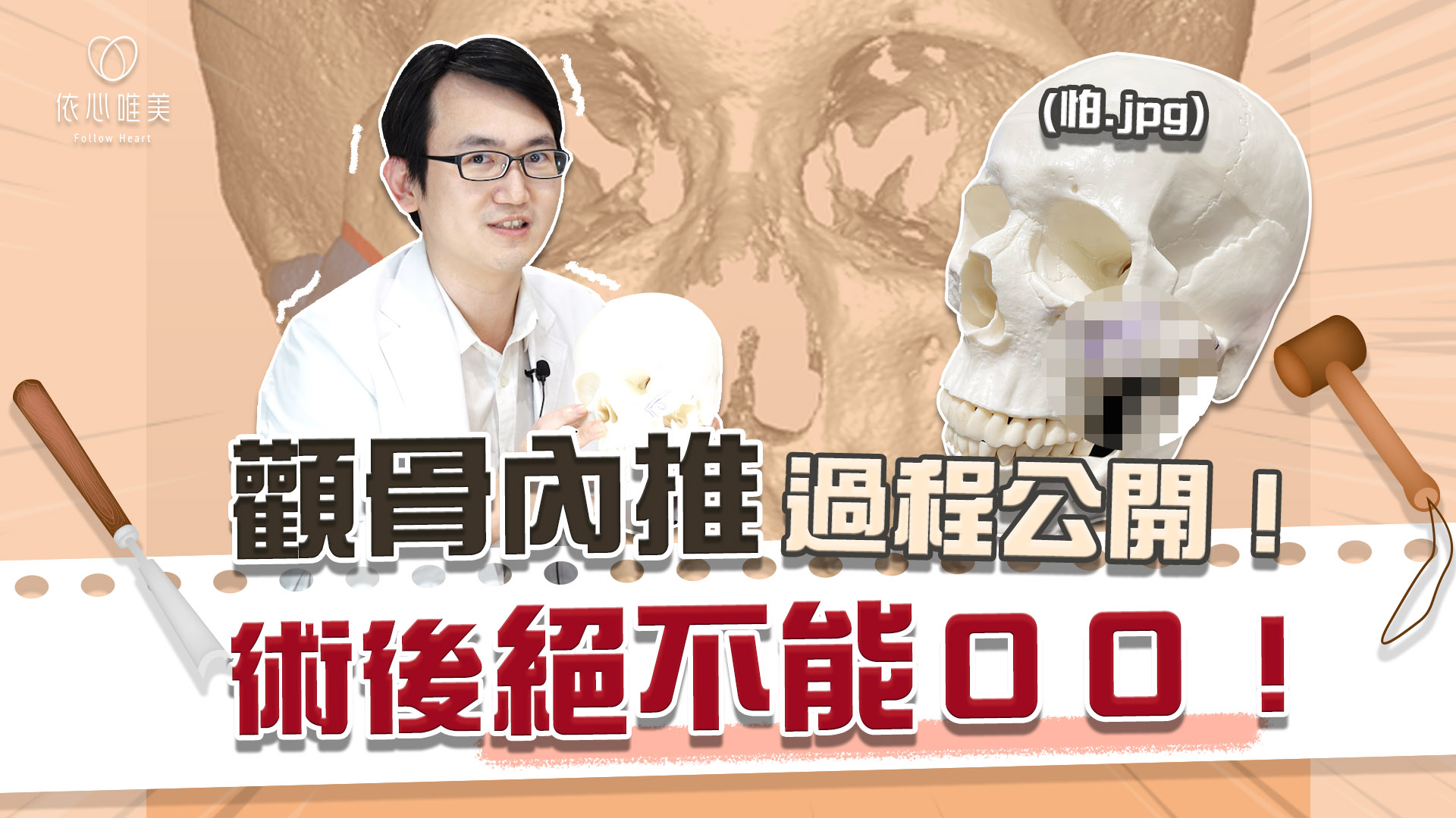 顴骨削骨後遺症多？術後照顧麻煩？上削骨解決「骨感」問題！