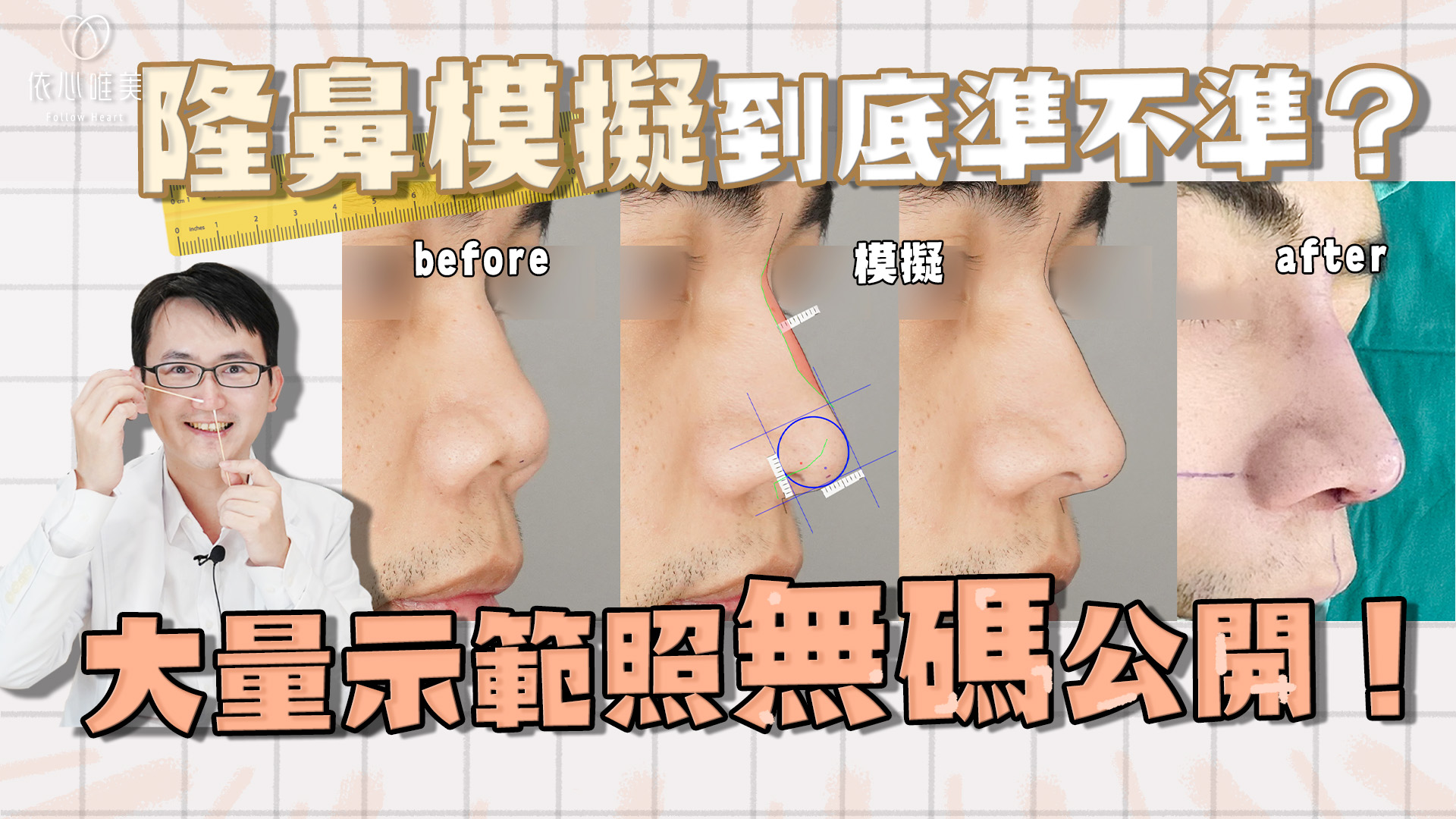 如何讓隆鼻更加滿意？術前模擬不可少！
