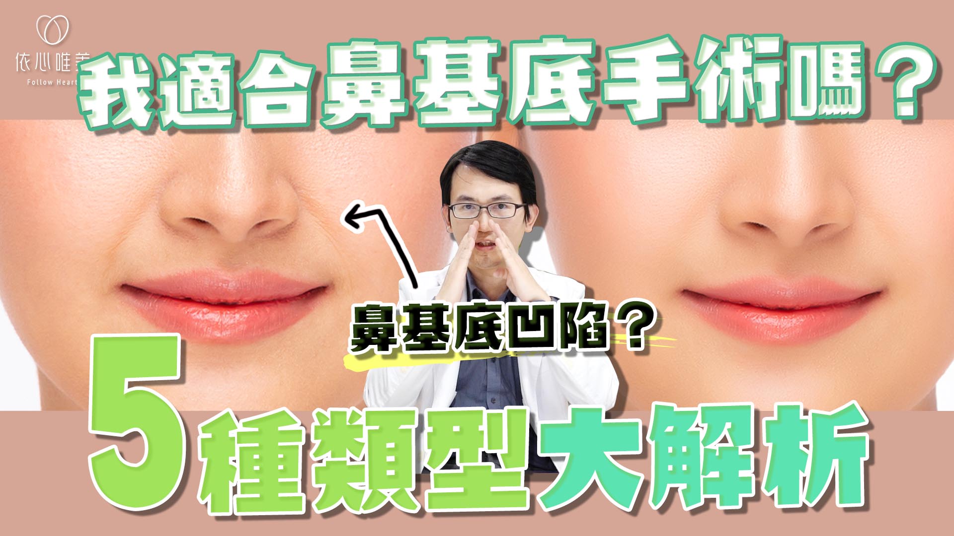 貴族手術在鼻整形上的應用！法令紋、貴族手術大解析