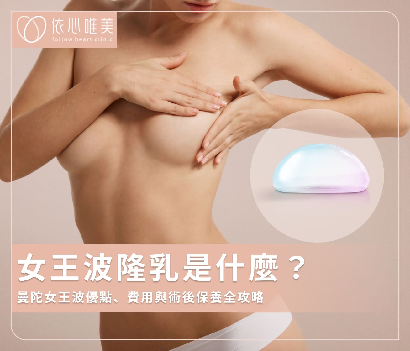 女王波隆乳是什麼？曼陀女王波優點、費用與術後保養全攻略