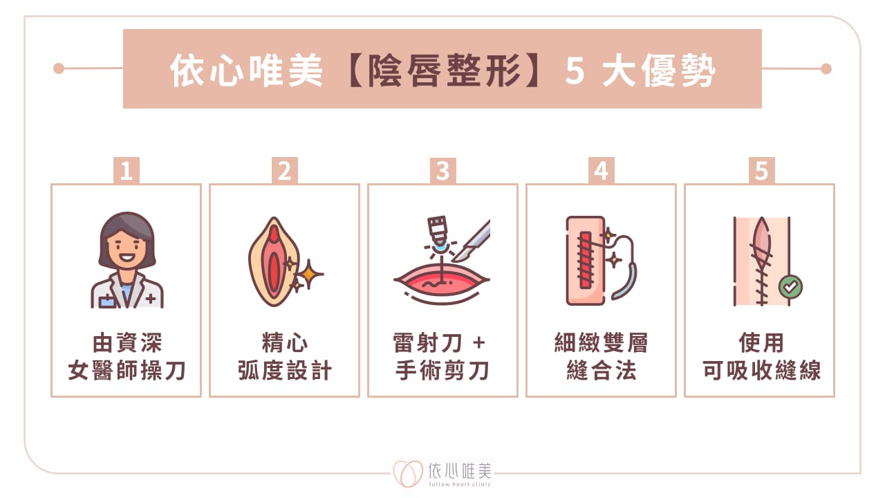 依心唯美陰唇整形5 大優勢