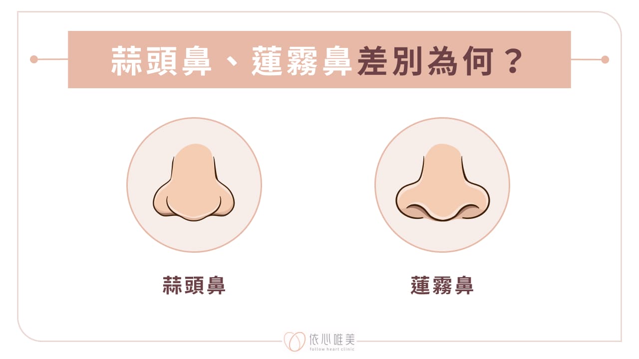 蒜頭鼻、蓮霧鼻