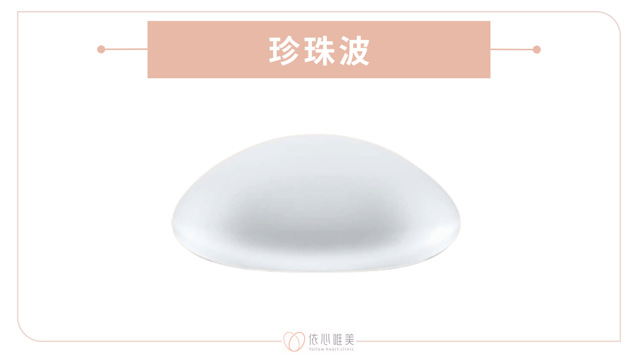 Perle (俗稱:珍珠波)