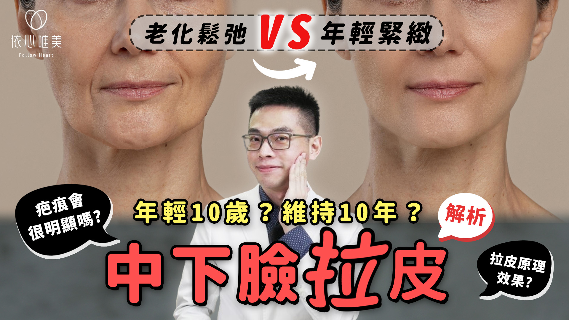 中下臉拉皮改善根本問題？才能徹底拯救鬆弛下垂！