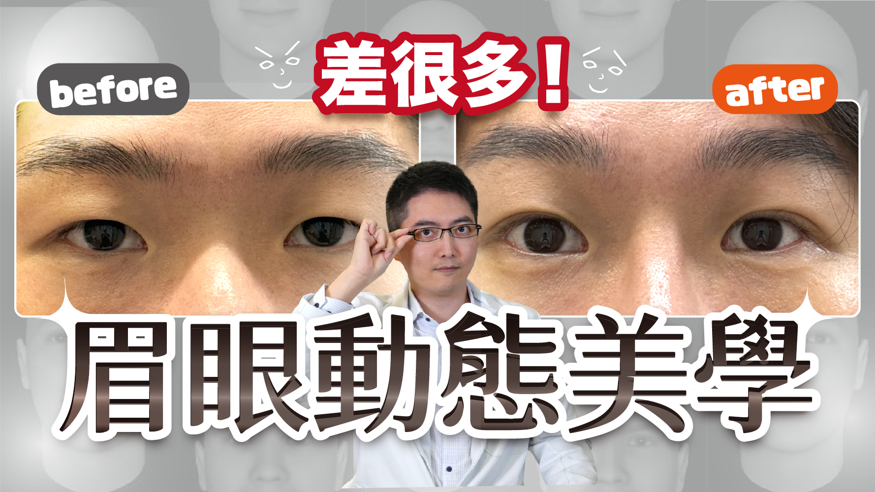 前額拉提居家檢測新法公開！動態vs靜態美學？