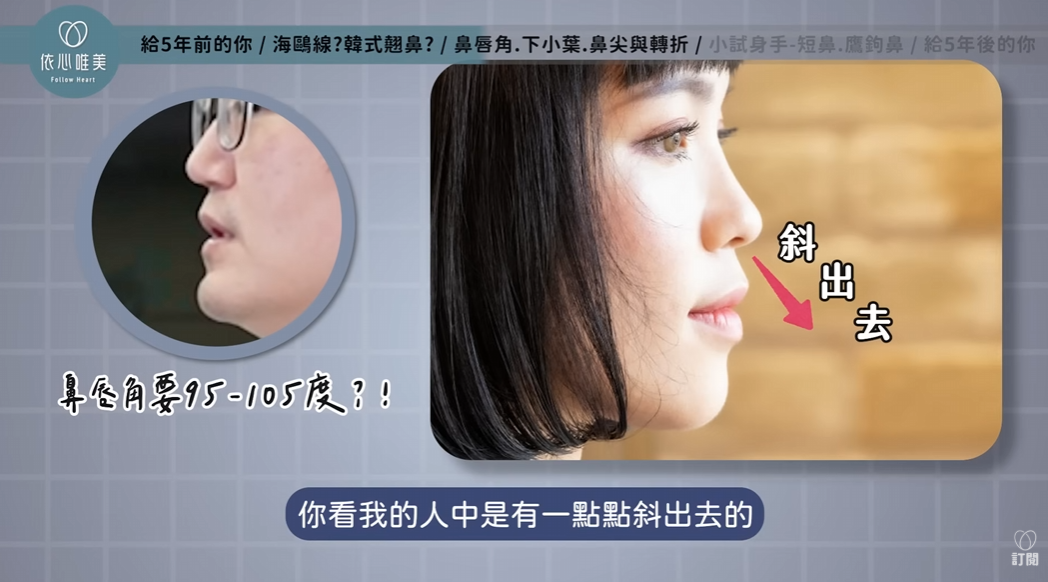 鼻唇角95到105度不一定適合亞洲人的示意圖