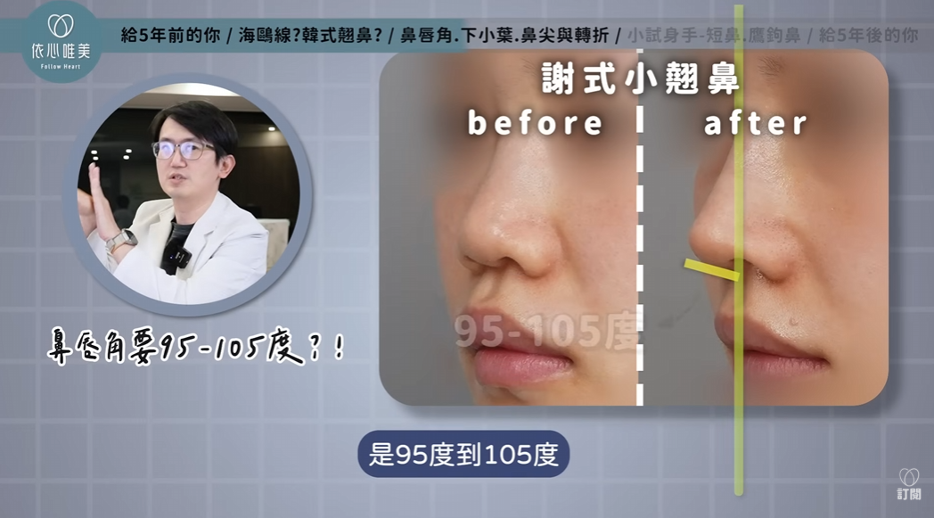 自然感小翹鼻術前術後與鼻唇角比例示意圖
