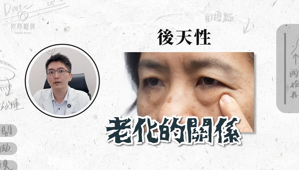 後天性眼瞼下垂